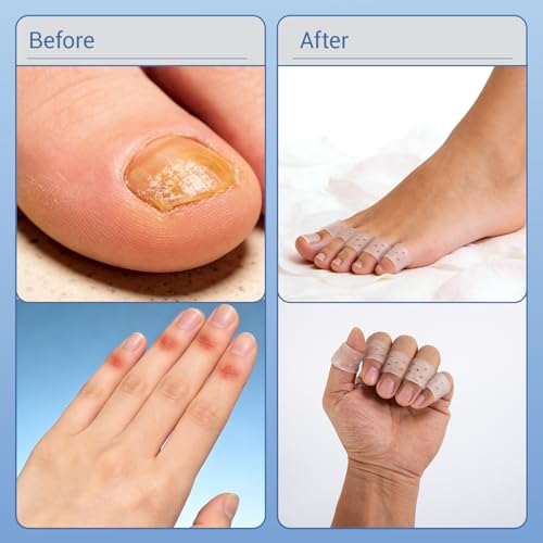 Silicone Finger Callus Protectors, Anti-Skin Picking Prevention Finger Cot