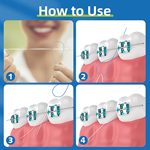 RioRand Orthodontic Floss Threaders for Braces - size: 50 Count (Pack of 4)